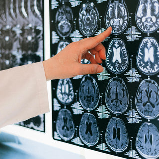 Can Homeopathy Help Heal the Brain? A Holistic Look at Concussion Recovery