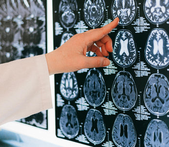 Can Homeopathy Help Heal the Brain? A Holistic Look at Concussion Recovery